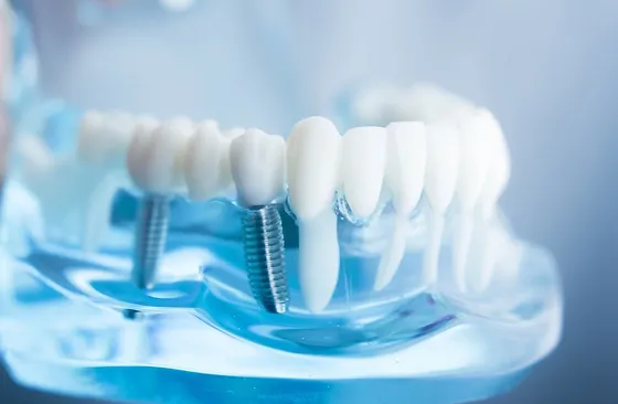 Implant Tedavisi Dis Hekimi Taylan Korkmaz Karsiyaka