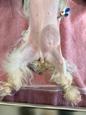 Affordable inguinal hernia hepair in Ellicott City, MD