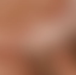 Handkolven vóór de geboorte: wanneer is het zinvol en wanneer juist niet?