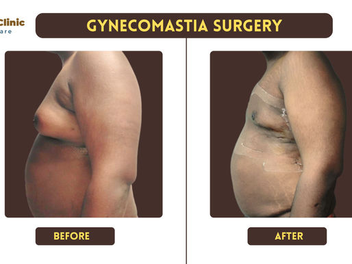 Get rid of enlarged breasts