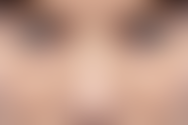 Blepharoplasty or Eyelid Surgery
