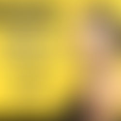 What is your biggest skin concern?