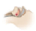 Airway-Closed.web_.jpg