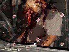 Matan a sangre fría a un hombre sobre la carretera federal Iguala Teloloapan.