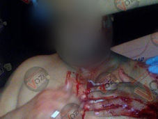 Balean a un hombre en la insurgentes.