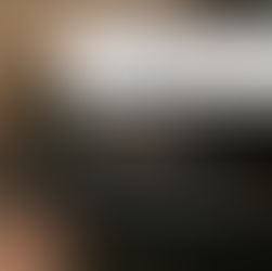 「リアボーテ ACスカルプ 凄い〜」頭皮イキイキ💆♀️✨白髪悩みの方にもおススメ🦳○