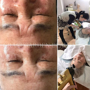 みるみる変わるお顔の変化に感動★リアボーテACトリートメント