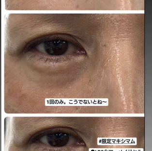 続報②✨若返りが凄い‼️😳😳😳【5000本限定】リアボーテグランスキンマキシマムの超限定バージョン「スキンマジックアイロン」シワ・クマ・クスミ一掃!ハリ・透明感もUP✨