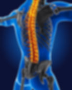 Spinal Deformities Treatment by Dr. Cristian Balcescu, MD | Orthopedic Spine Surgery in Casper Wyoming