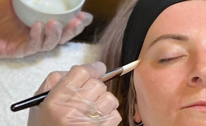 Chemical peel treatment at Luminous Skin Richmond