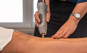 Laser skin rejuvenation treatment at Motueka Laser and Skin Clinic