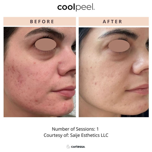 semaglutide louisville 🩺 Now accepting NEW PATIENTS into our medical weight loss program. 🩺 We  offer the most cutting-edge, science-backed tools in our Rejuv Weight Loss  Program, including Semaglutide. Many of our patients have