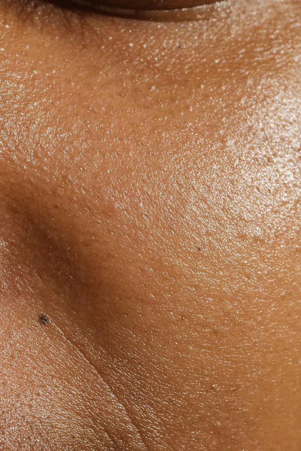 Large Pores on a patient