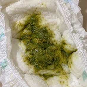 Bebê fazendo cocô verde. É normal?