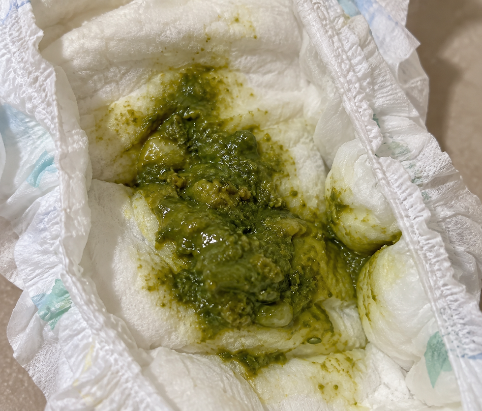 Bebê fazendo cocô verde. É normal?