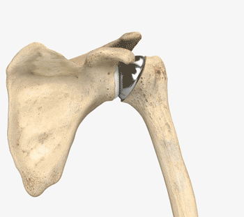 MSS_Anatomic.gif