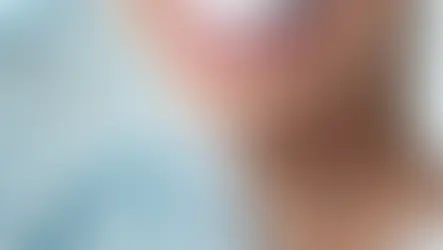 Diş beyazlatma (Dental Bleaching) nedir?