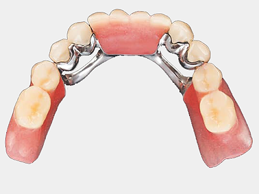 chrome-dentures.png