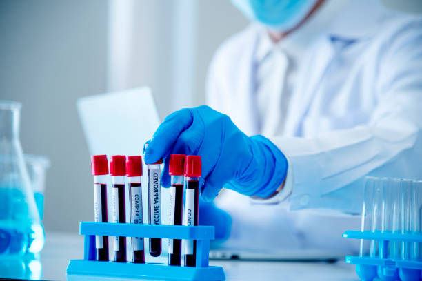 blood test lab