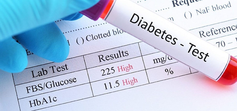 Diabetes - Tests