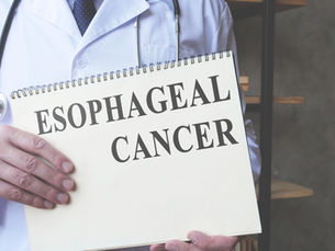 Understanding Esophageal Cancer: An Infographic Overview