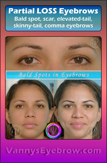 Tattoo Bald Spot in Eyebrow