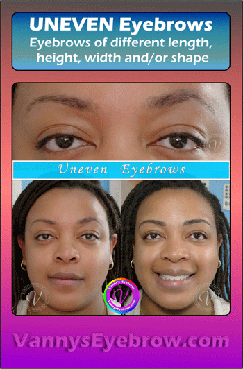 Microblading Uneven Brow