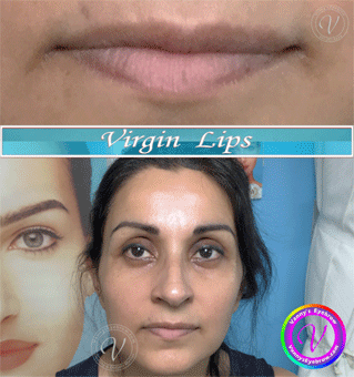 Permanent Makeup Lips Before and After