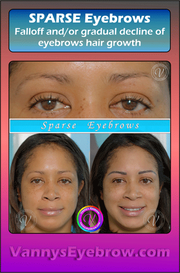 Microblading to Correct Sparse Brow