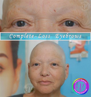 Alopecia EyeBrow & Eyelash Styling