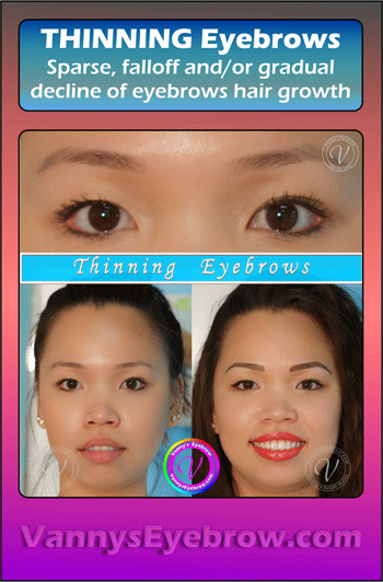 Sparse Brow Restoration with Permanent Makeup