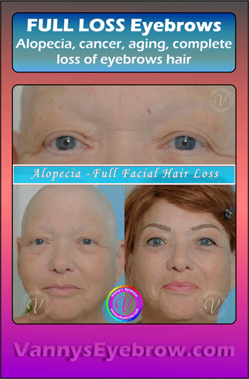 Alopecia Eyebrows Permanent Makeup