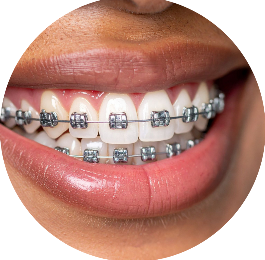 Design sem nome (27)_edited