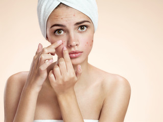 Daily Vitamin D Supplement May Inversely Affect Acne