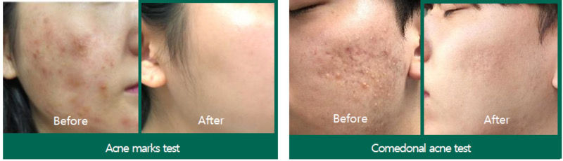 Thumbnail: 30 DAYS MIRACLE CREAM