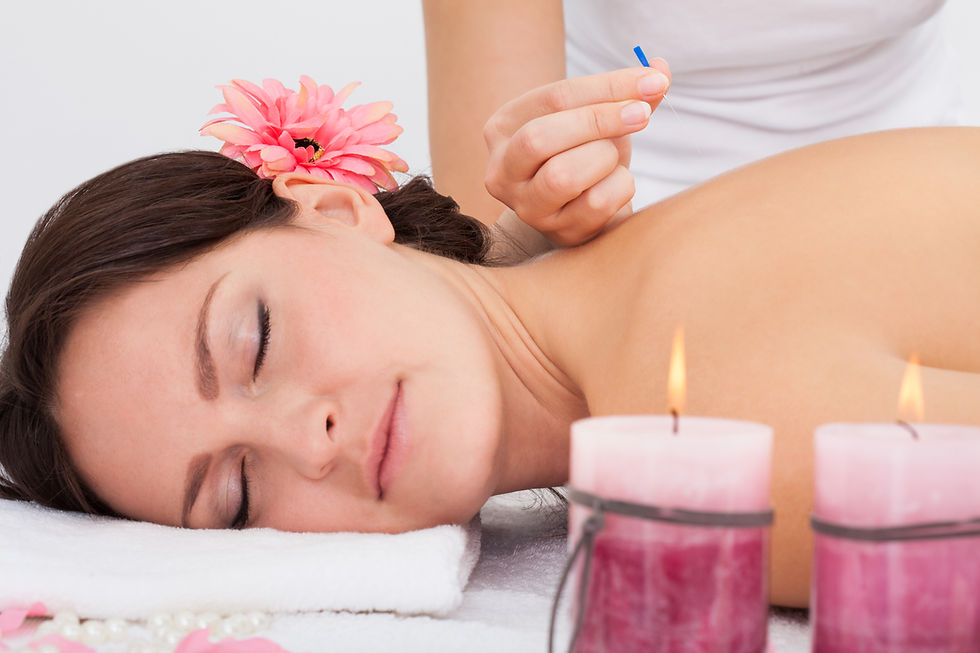 Young Woman Lying On Massage Table Getting Acupuncture Therapy From Masseuse.jpg