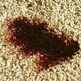 Remove Blood From Carpet-min.jpg