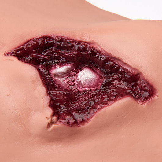 Thumbnail: Multiple Casualty Simulation Kit
