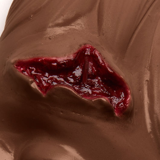 Thumbnail: Lacerated Forehead - Dark