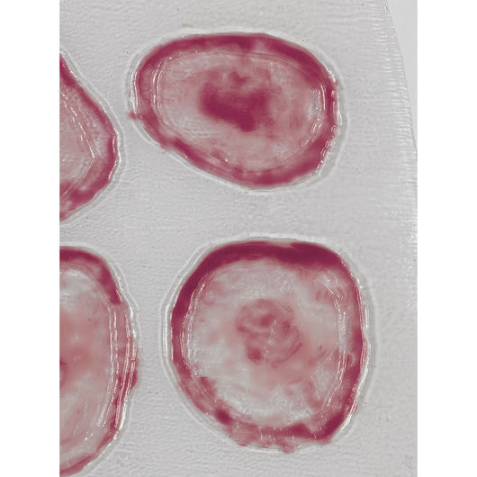 Life/form® Wound - Lyme Disease Roll