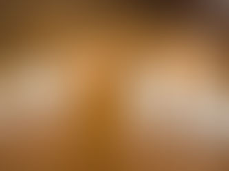 Dislocation & Relocation