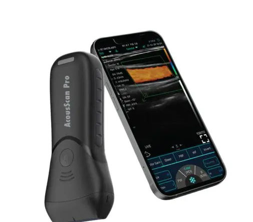 AcousScan Pro 先進手持式的便攜超音波醫學影像。