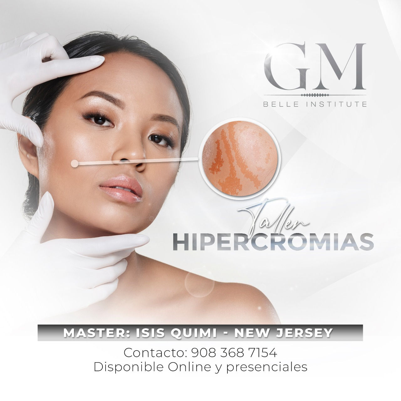 Taller Hipercromias (Manchas)