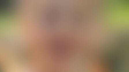 Verder leven zonder haar, is dat mogelijk?