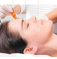 Microneedling Kosmetikstudio
