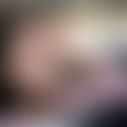 Motion sickness: First aid