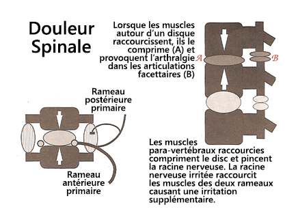 Fig.2