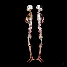 Two skeletons standing side by side against a black background, contemporary fine art.