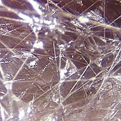 fascia-tissus conjonctif