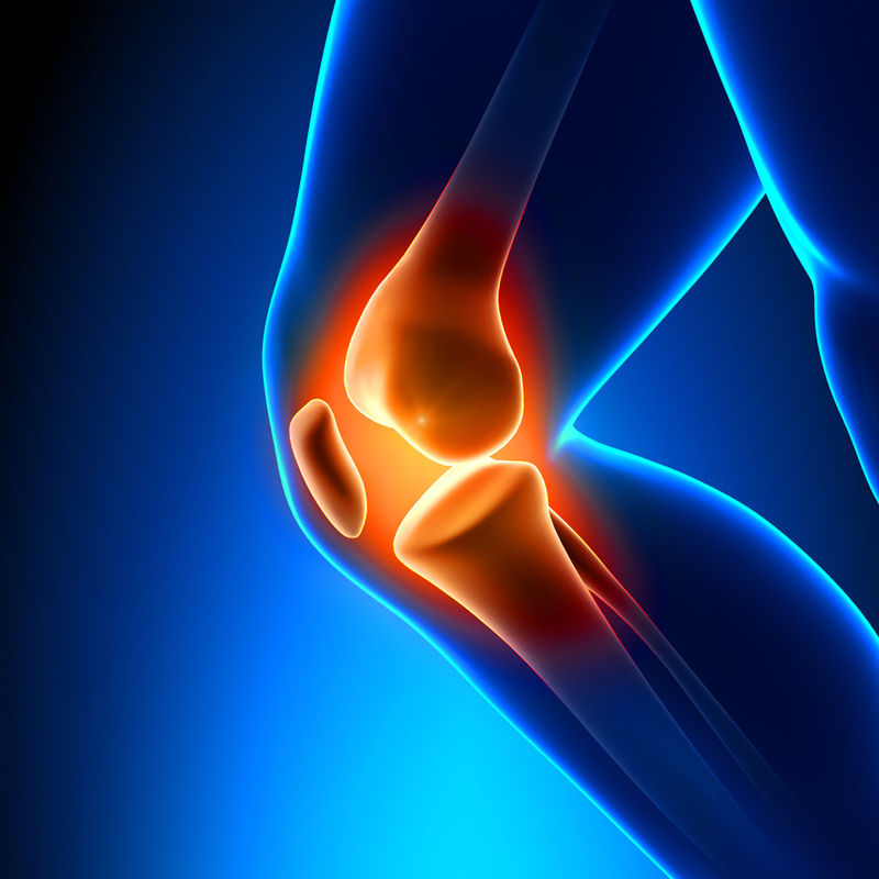 Knee Osteoarthritis and the Brain's Broken Pain Off-Switch